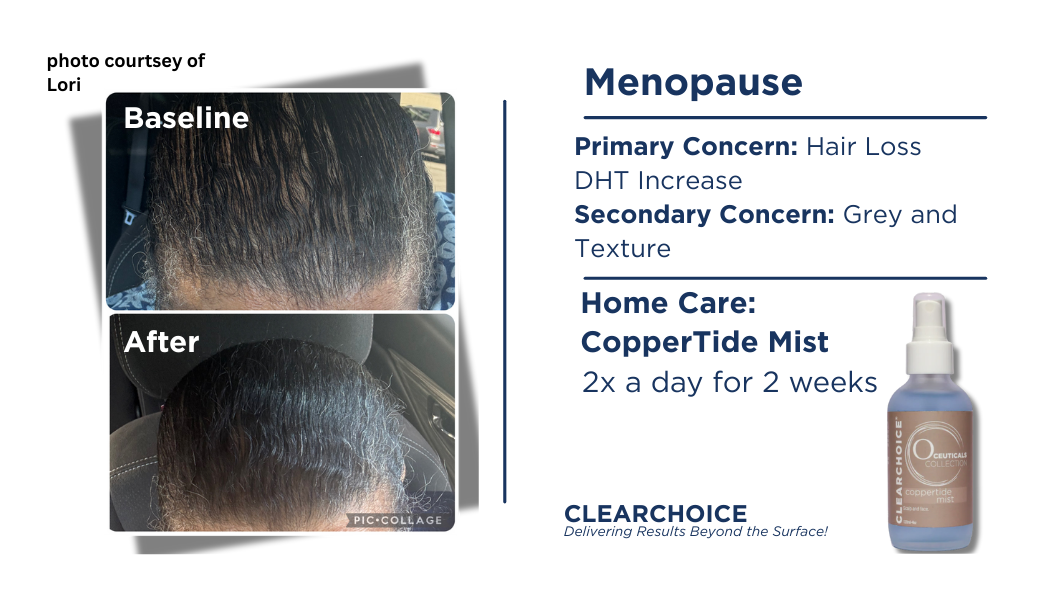 ClearChoice O-Ceuticals CopperTide Mist (120 ml)