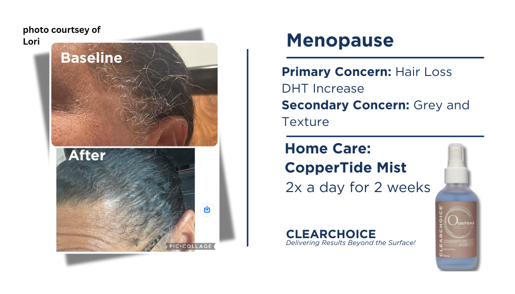 ClearChoice O-Ceuticals CopperTide Mist (120 ml)